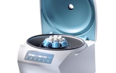 Tout savoir sur la centrifugeuse médicale